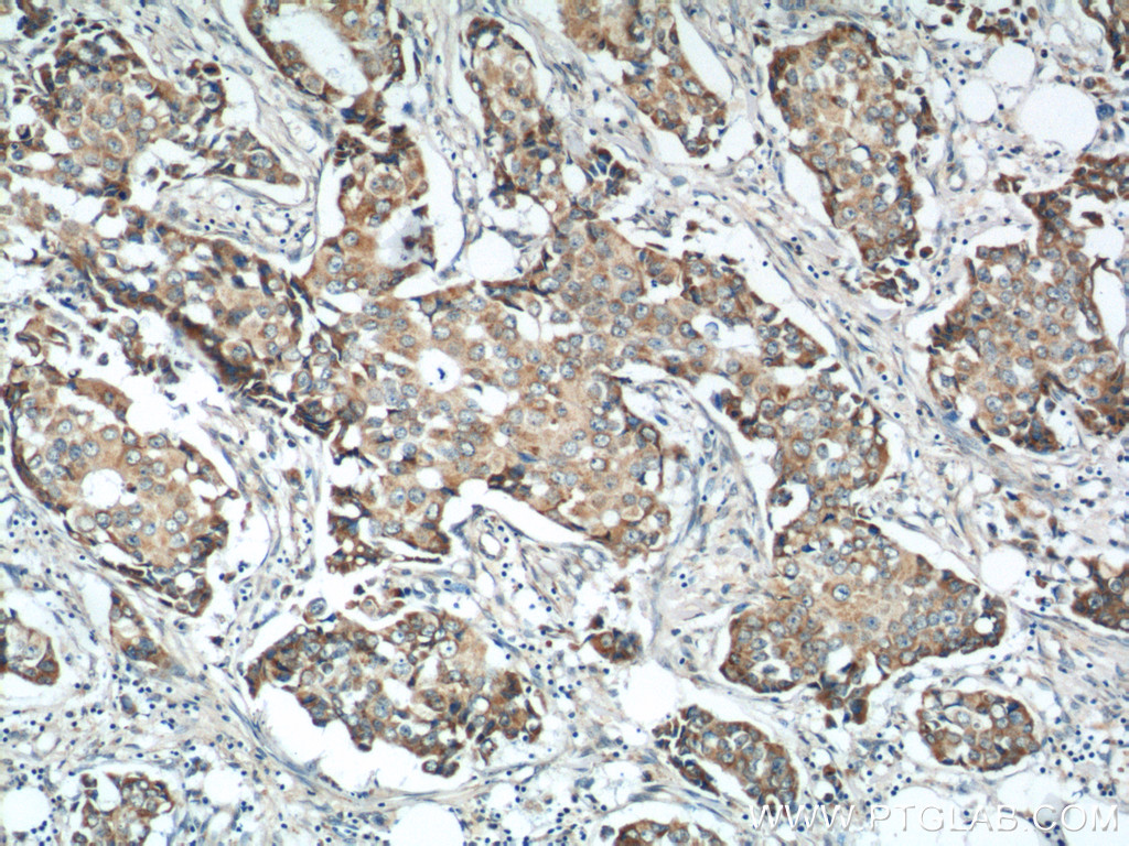 MICB Polyclonal antibody