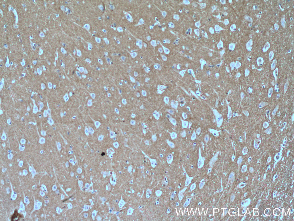 RHOB Polyclonal antibody