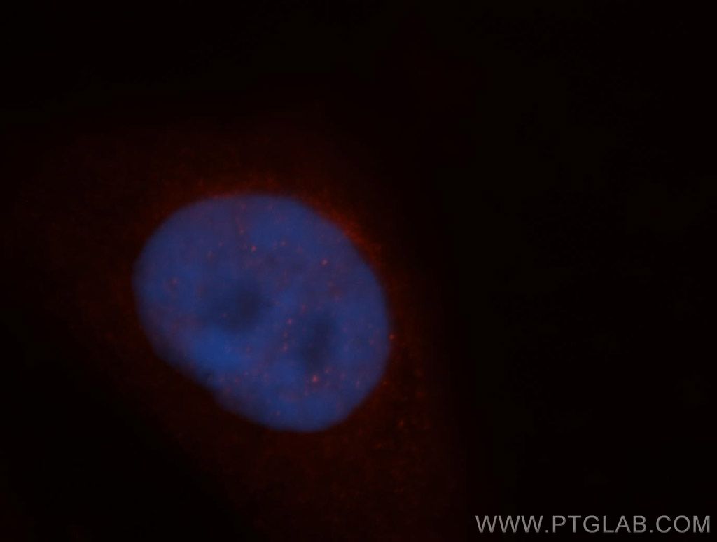 ADAR1 Polyclonal antibody