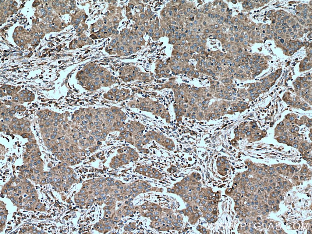 PALB2 Polyclonal antibody