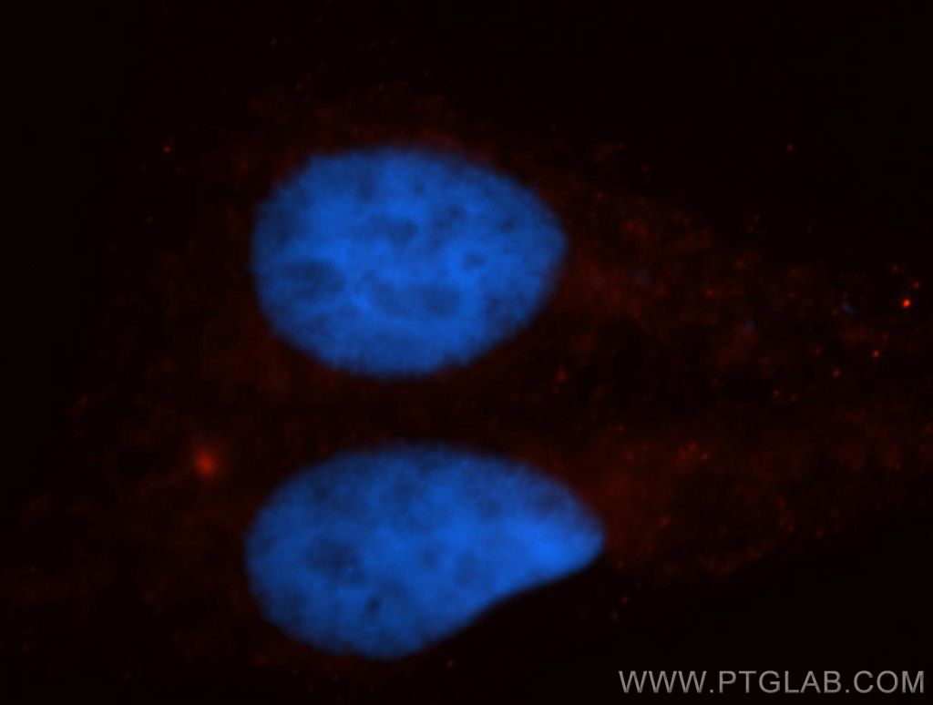 KIF4A Polyclonal antibody