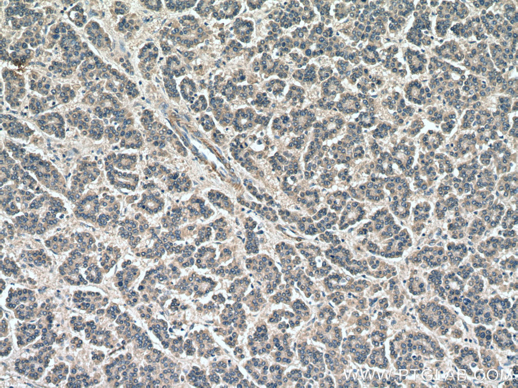 USP1 Polyclonal antibody