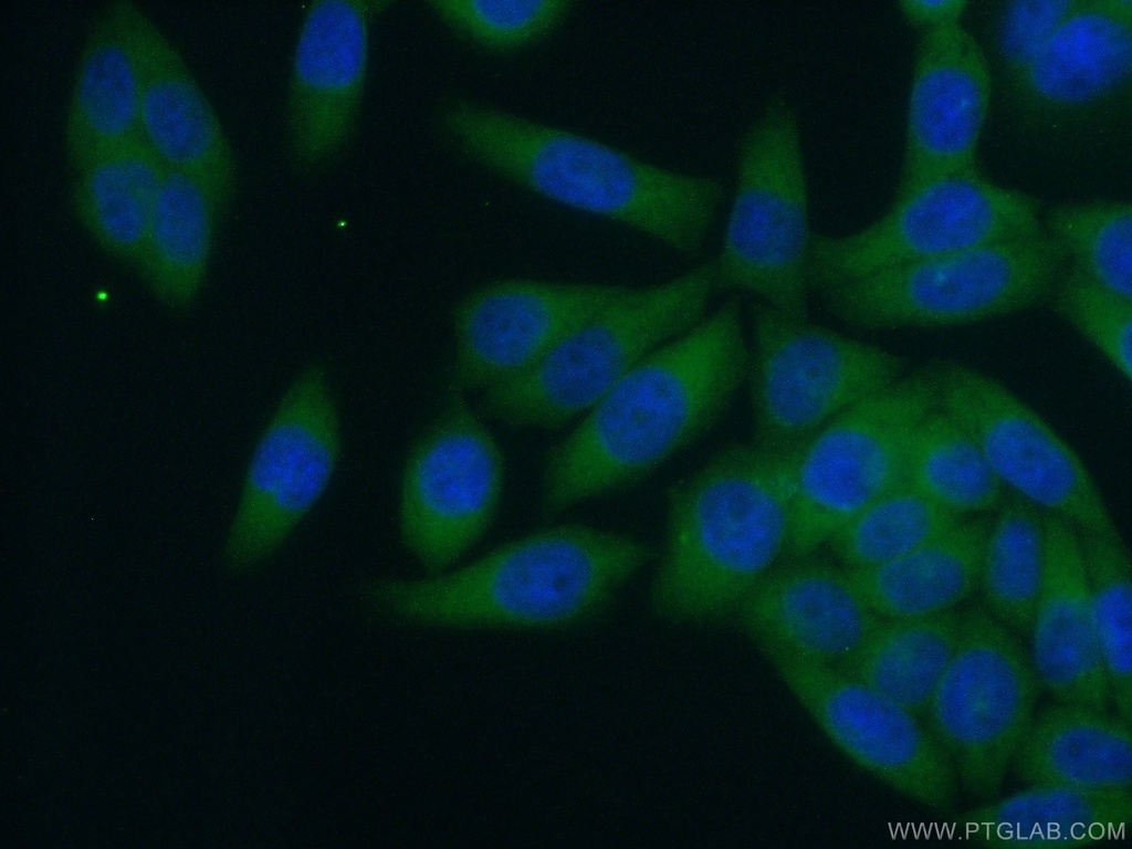 RABEP1 Polyclonal antibody