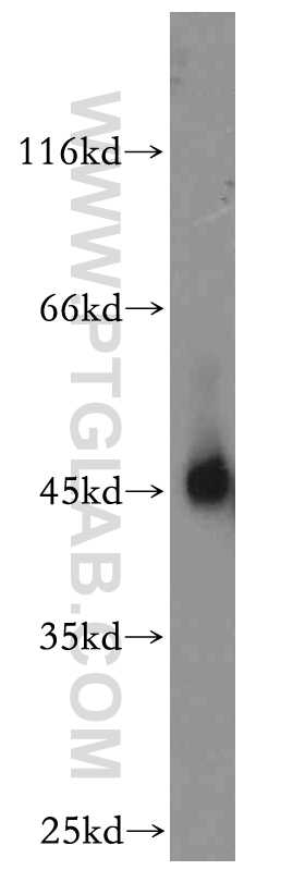 NR1H3 Polyclonal antibody