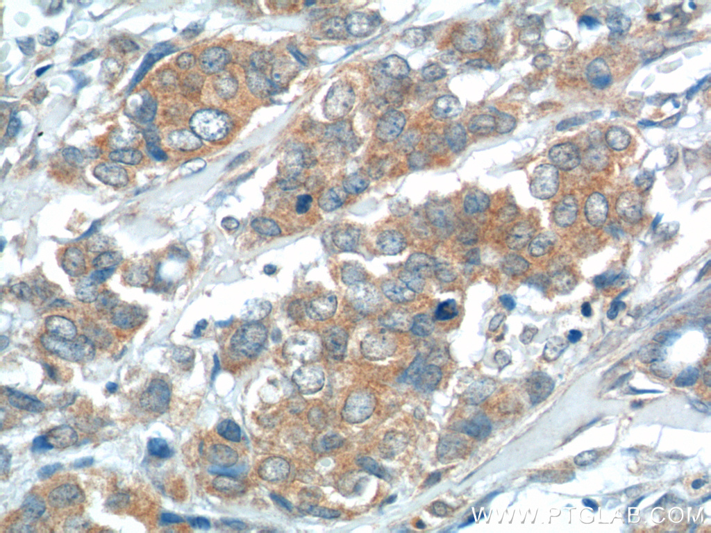 USP15 Polyclonal antibody