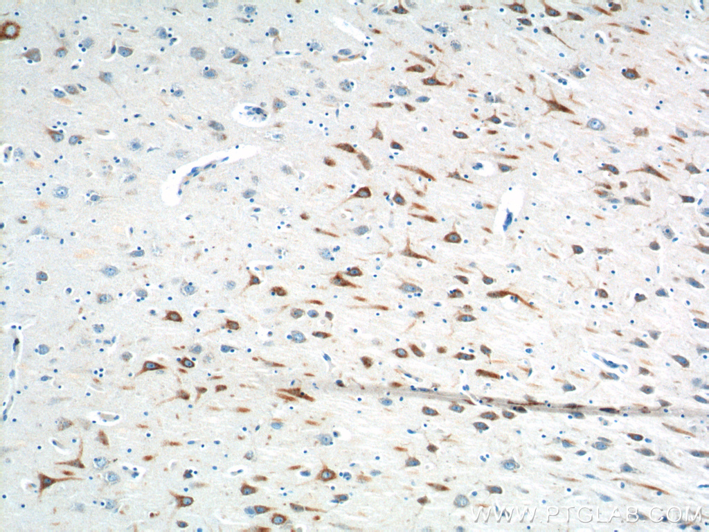 PTGER3 Polyclonal antibody