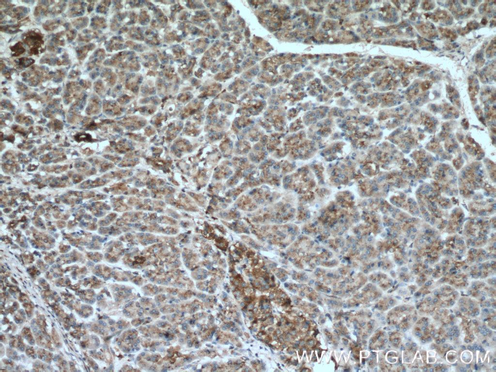GAA Polyclonal antibody