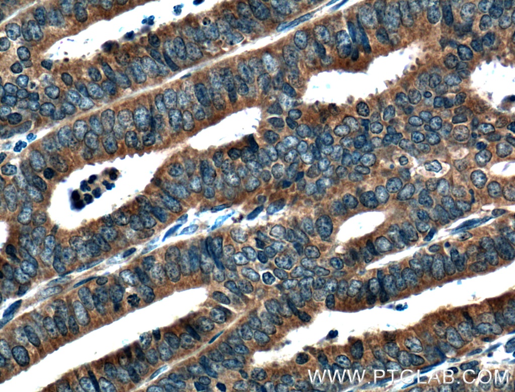 MTMR2 Polyclonal antibody