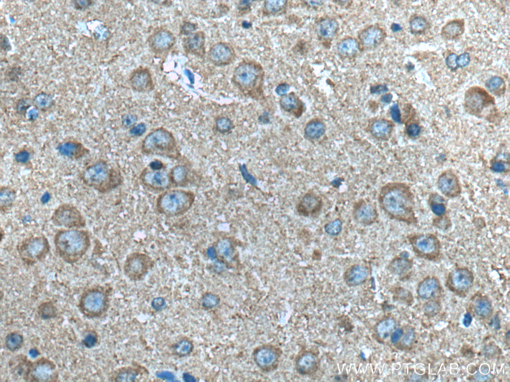NTM Polyclonal antibody