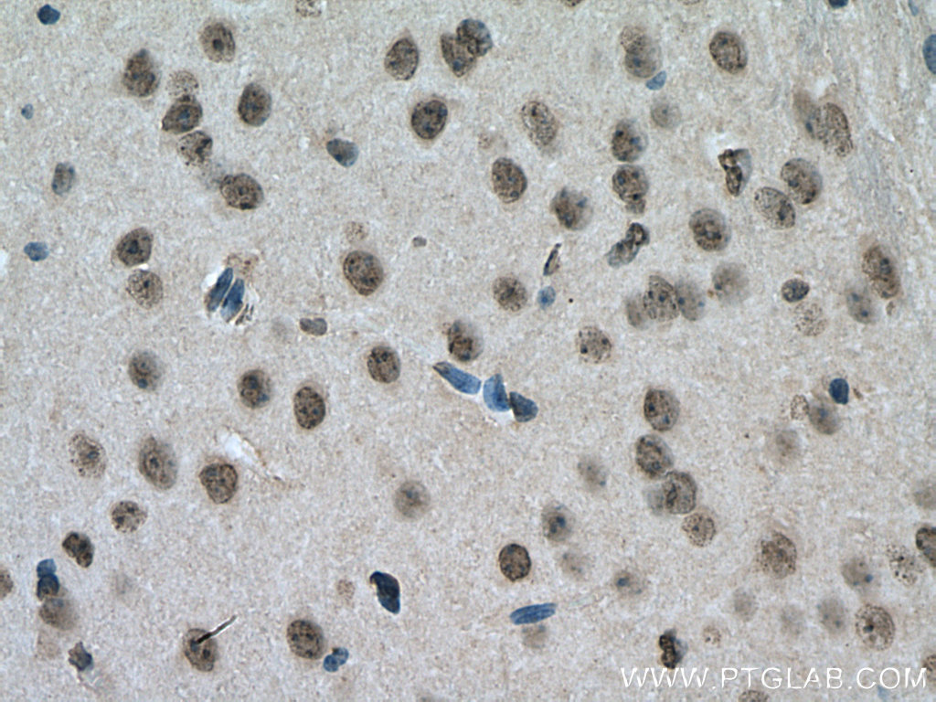 YTHDC1 Polyclonal antibody
