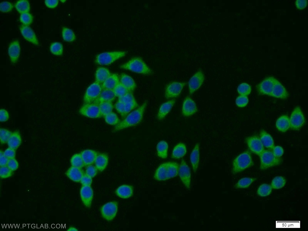 SCP2/SCPx Polyclonal antibody