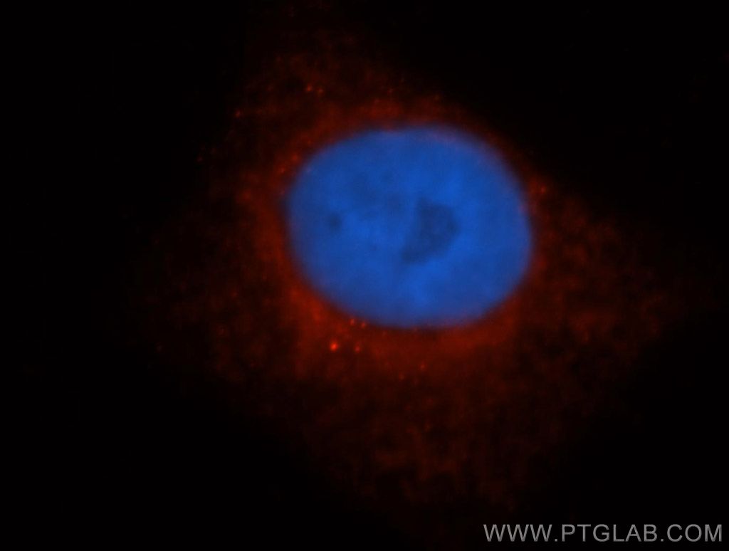 LDHD Polyclonal antibody