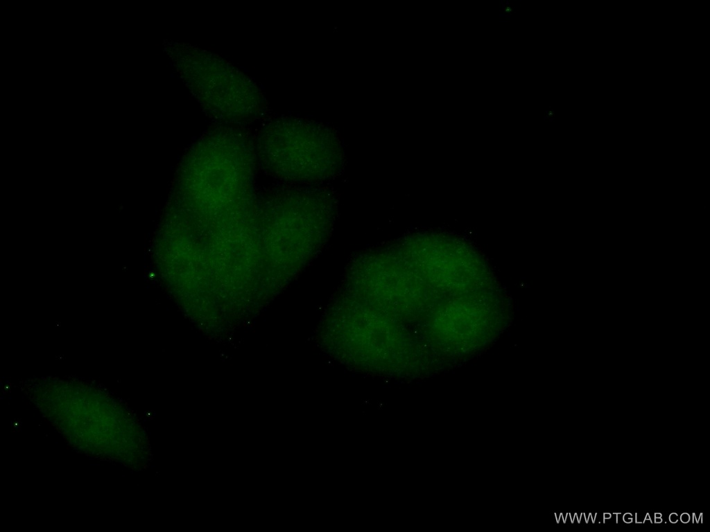 IPO11 Polyclonal antibody