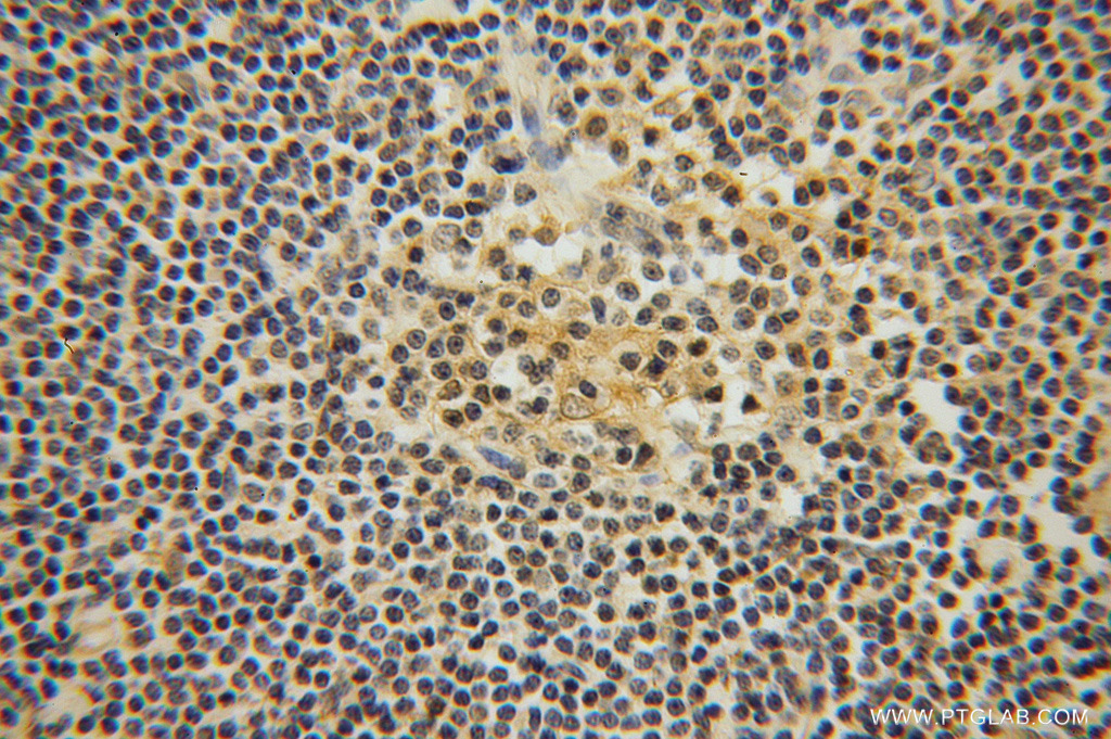 ITM2A Polyclonal antibody