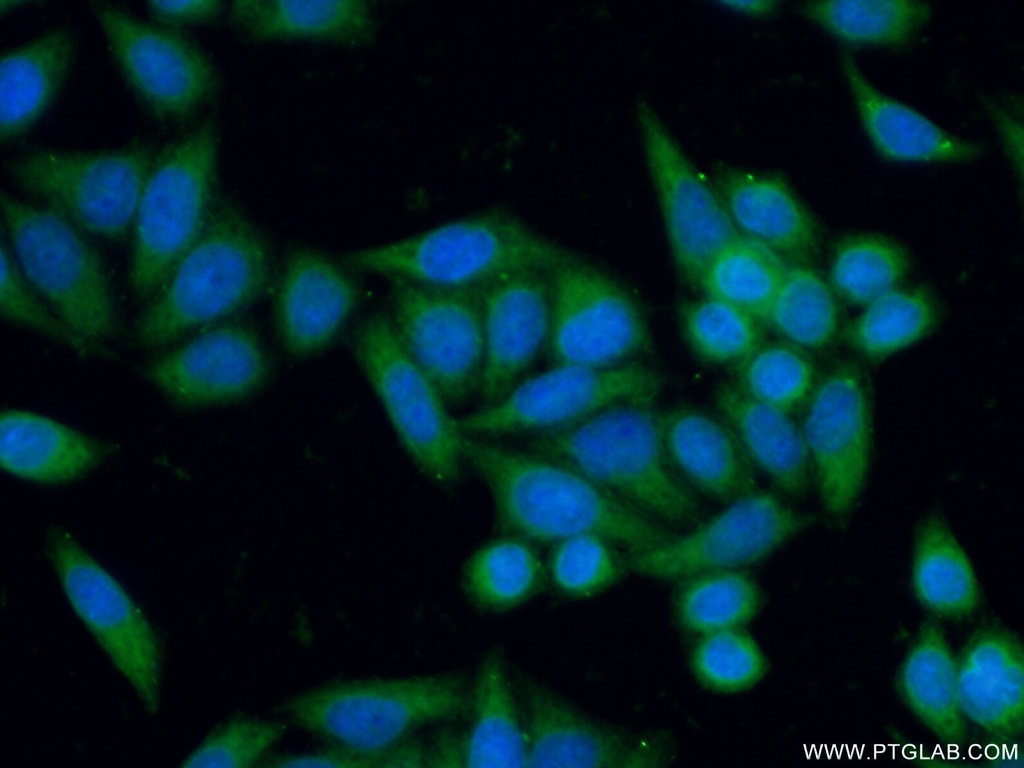 GALE Polyclonal antibody