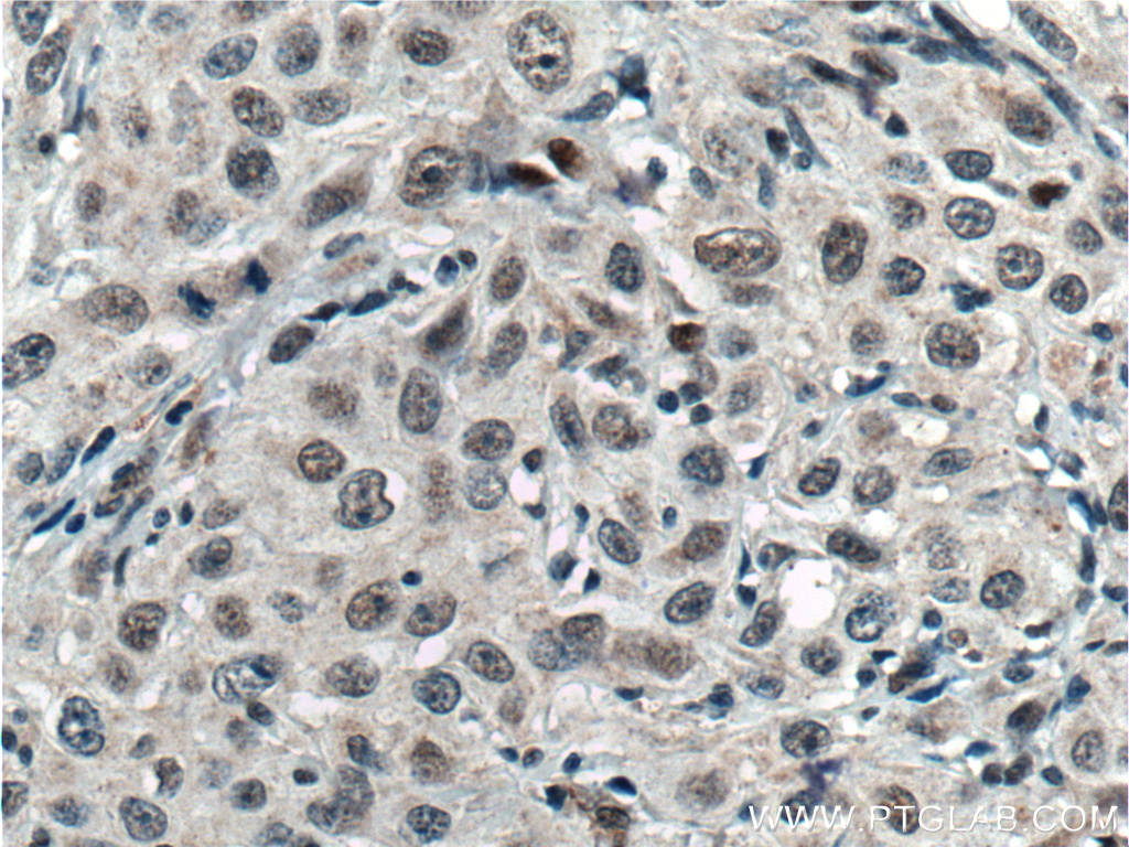 TCF12/HEB Polyclonal antibody