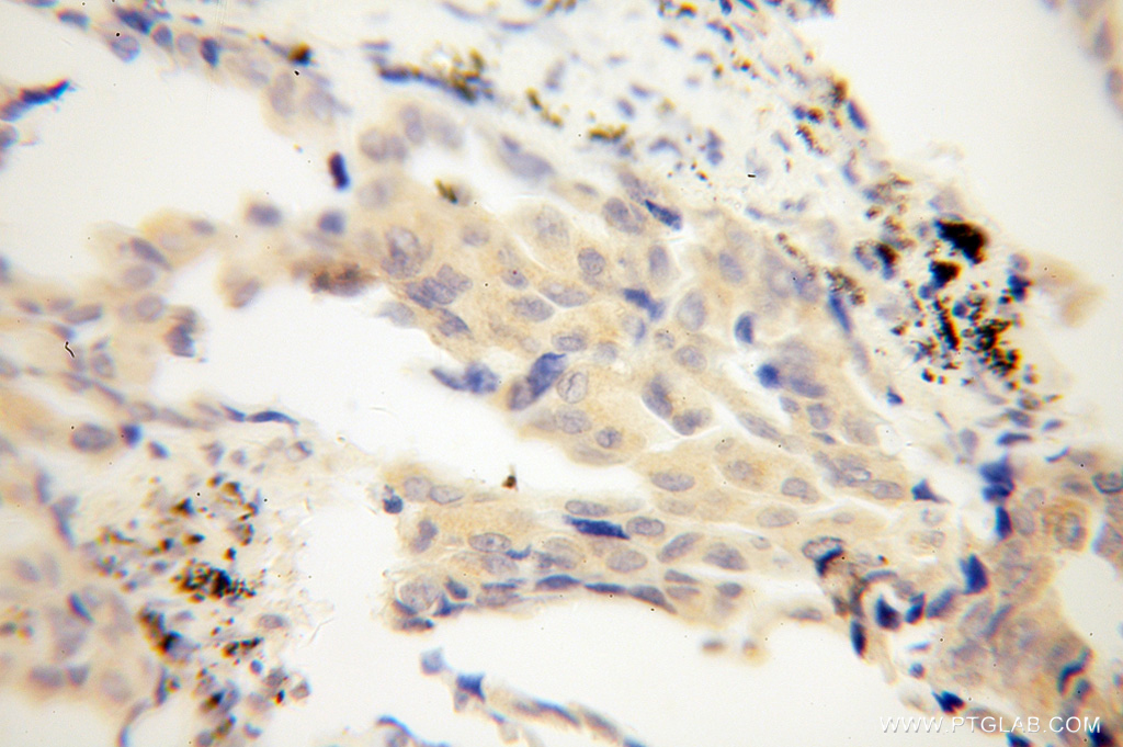 CHSY1 Polyclonal antibody