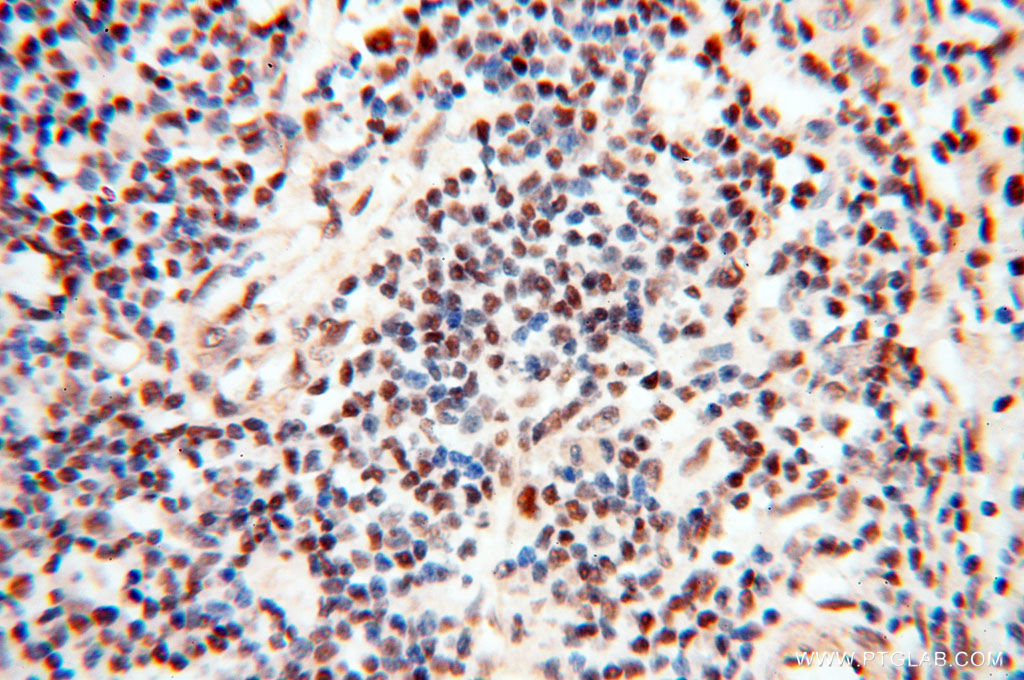 TIMELESS Polyclonal antibody