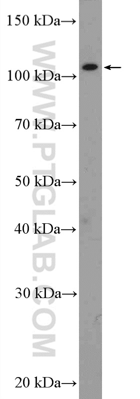 SETDB2 Polyclonal antibody