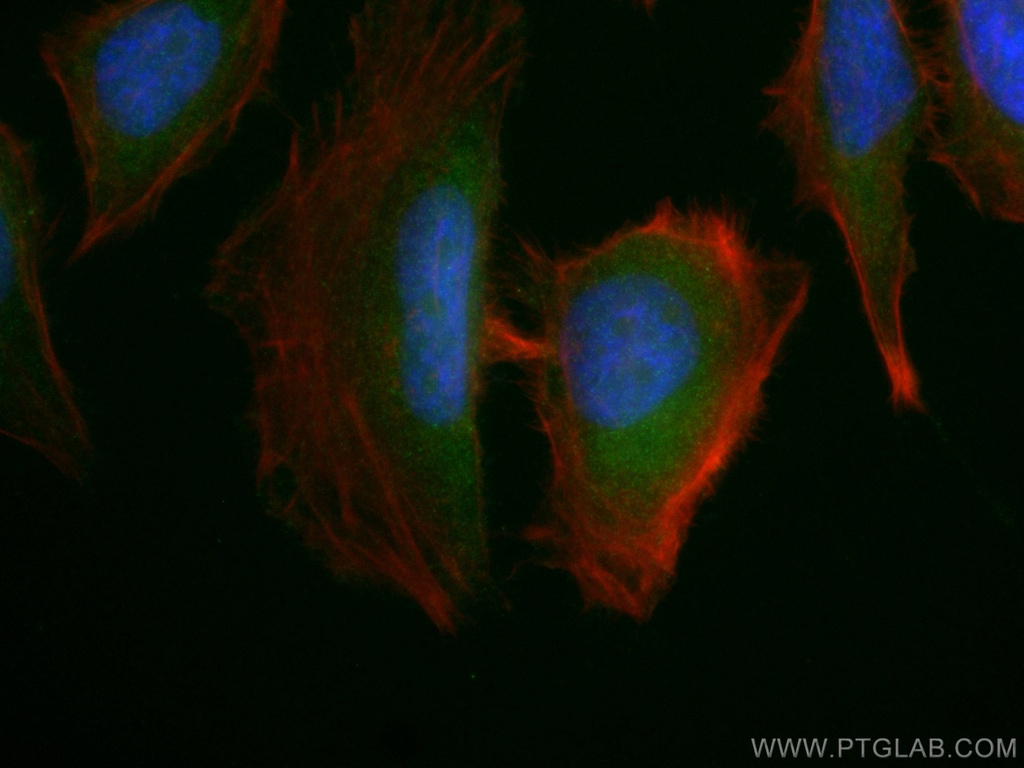 AMPK Beta 2 Polyclonal antibody