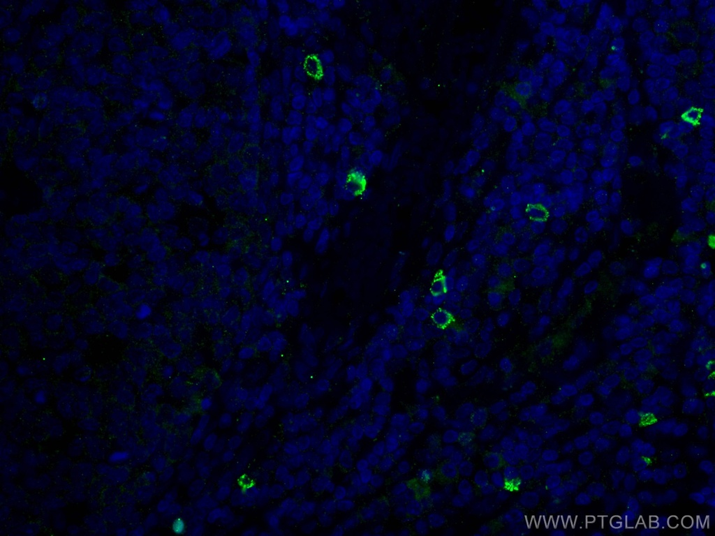 TMPRSS2 Polyclonal antibody