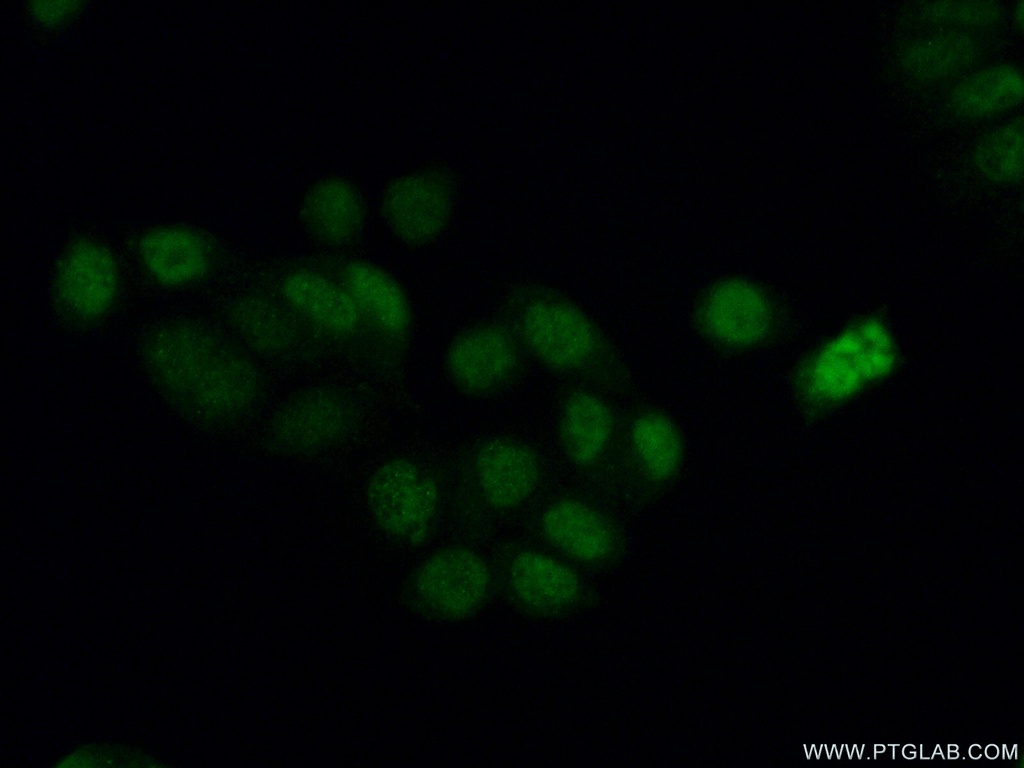 Phospho-RCC1 (Ser11) Polyclonal antibody