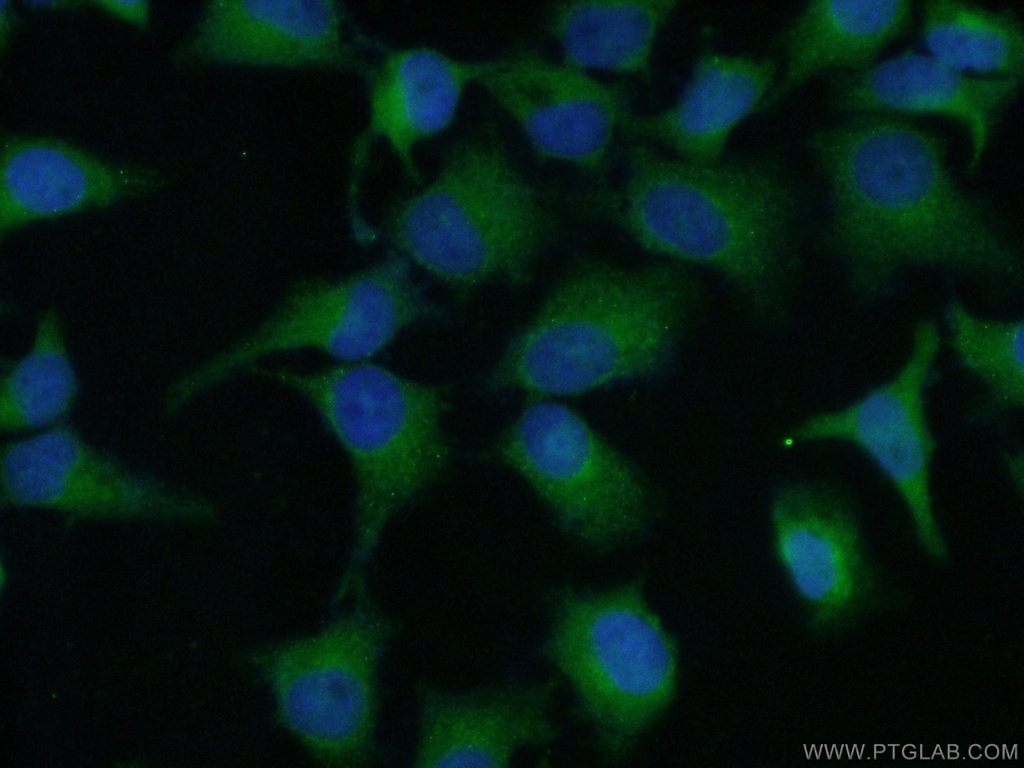 RSK3 Polyclonal antibody