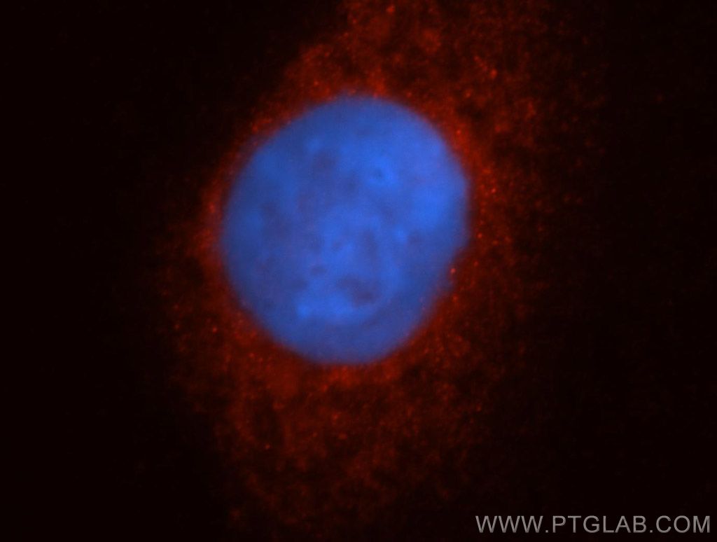 CYP17A1 Polyclonal antibody