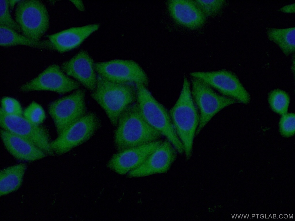 RABGGTA Polyclonal antibody