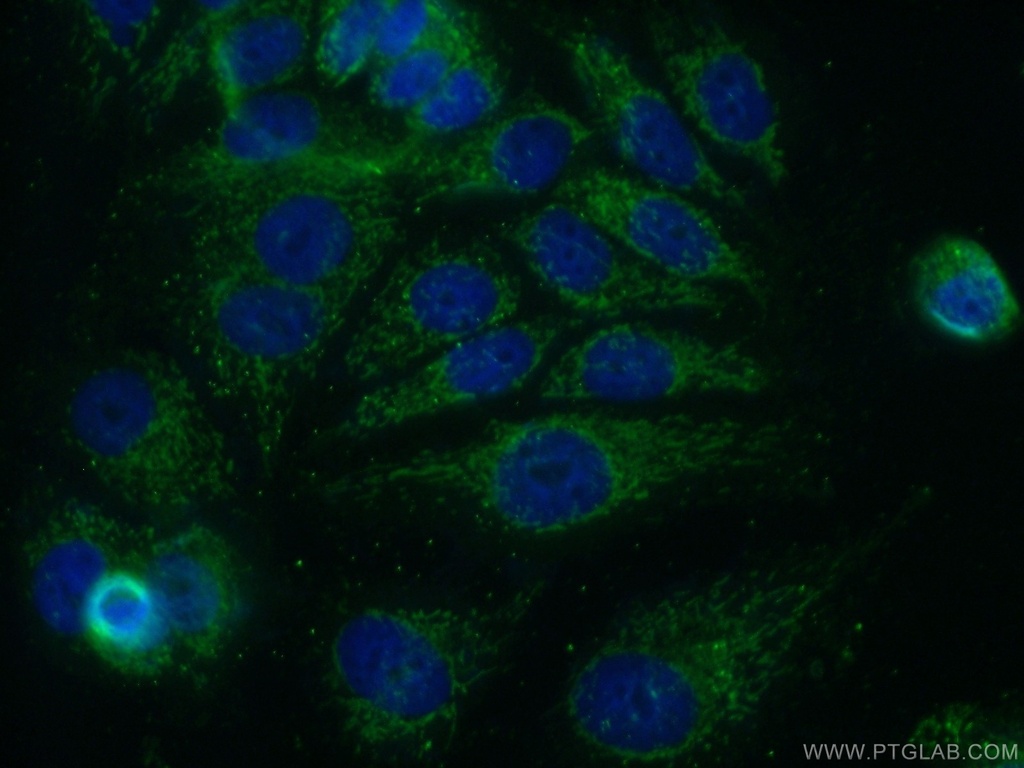 KLHL2 Polyclonal antibody