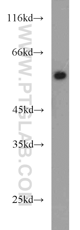 PLVAP Polyclonal antibody