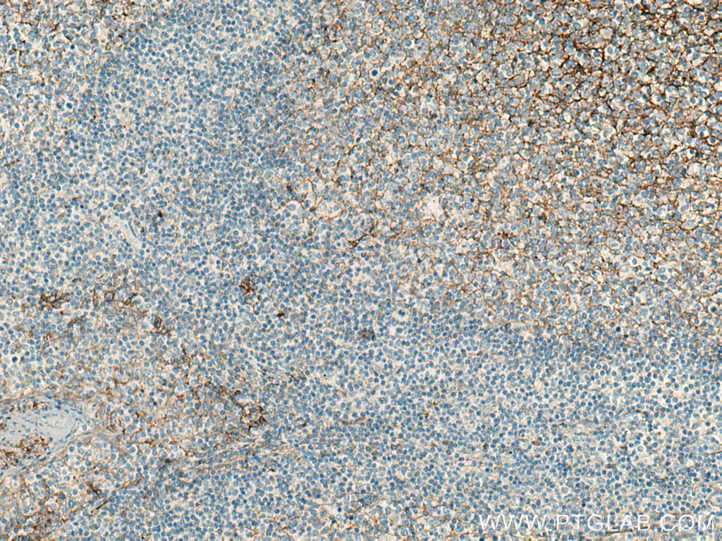 B7-H3 Polyclonal antibody