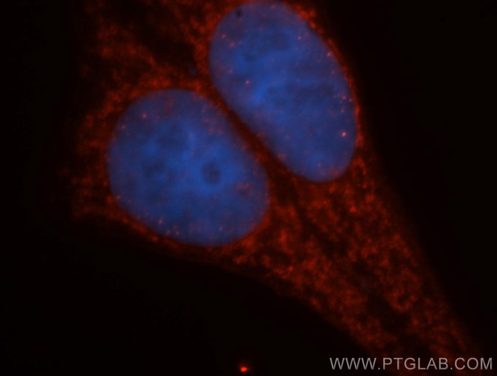 GLUD2 Polyclonal antibody