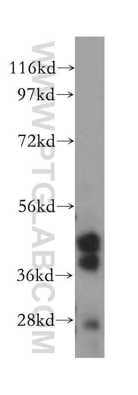 PARVB Polyclonal antibody