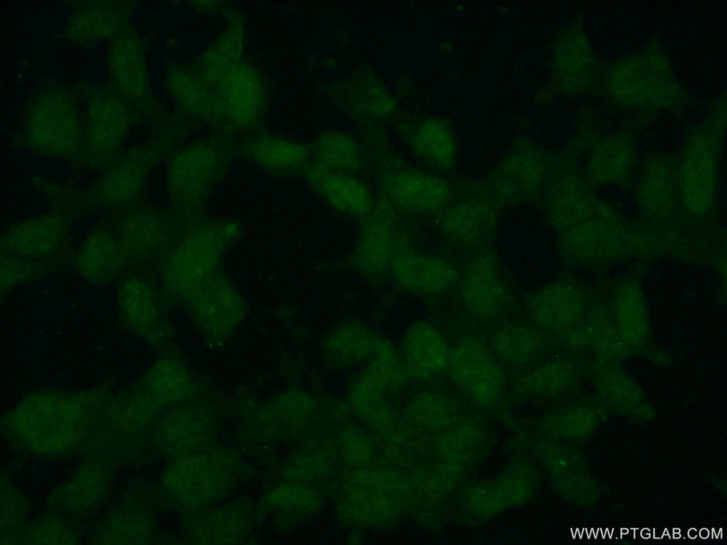 SMC6 Polyclonal antibody