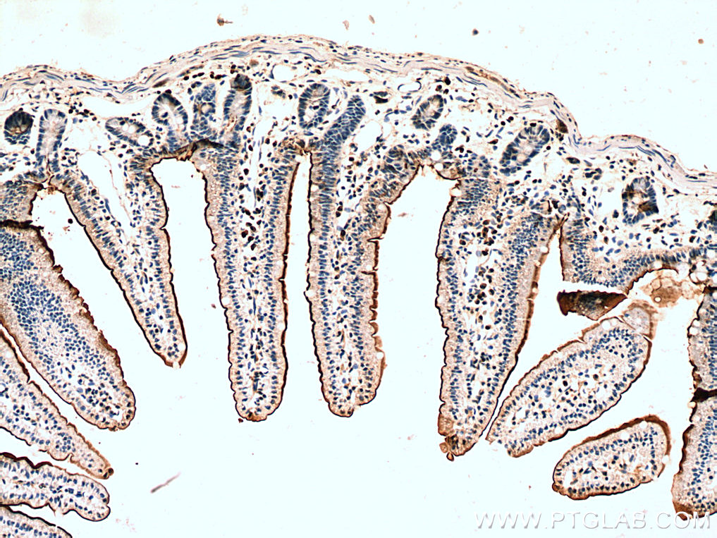 MYO7B Polyclonal antibody