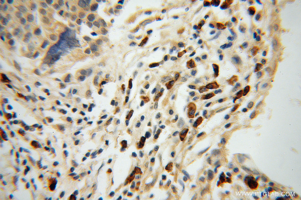AIG1 Polyclonal antibody