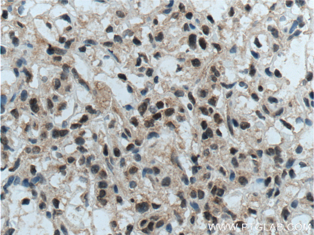 TFE3 Polyclonal antibody
