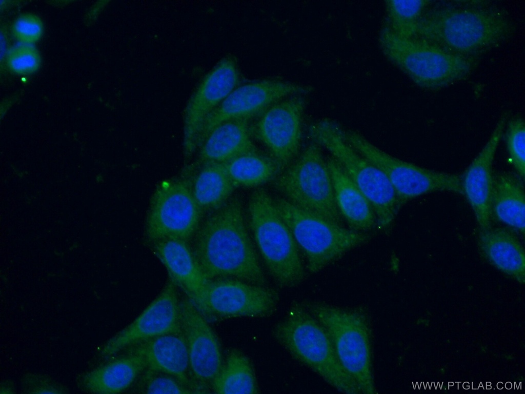 PSPH Polyclonal antibody