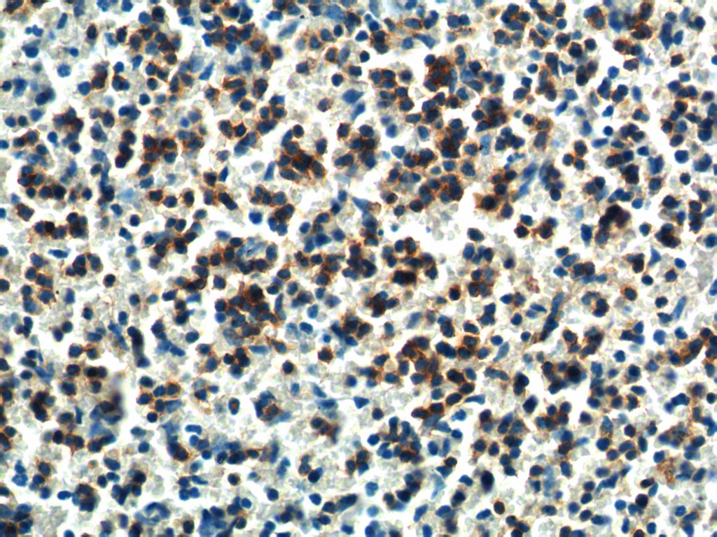 PTPN5 Polyclonal antibody