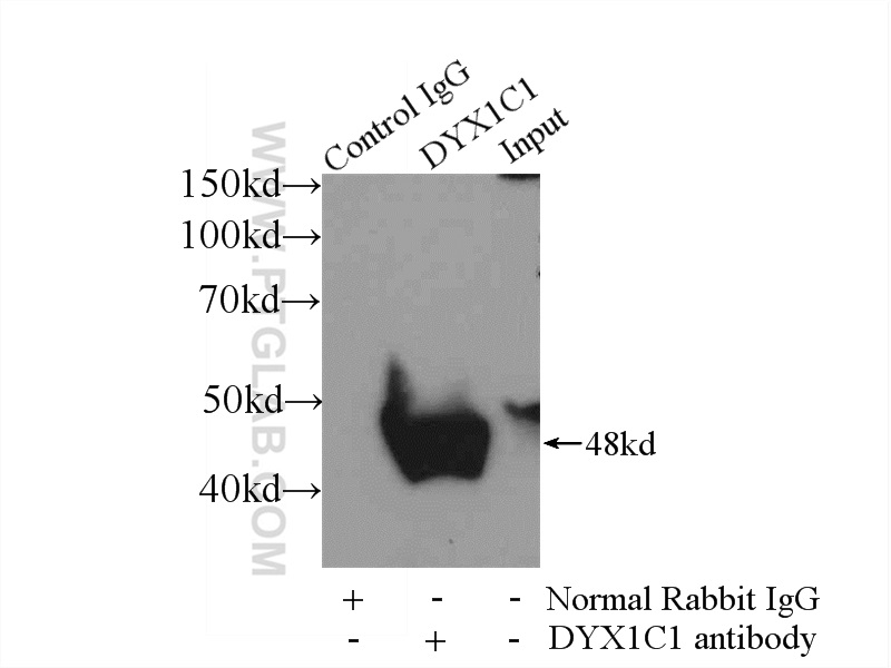 DYX1C1 Polyclonal antibody