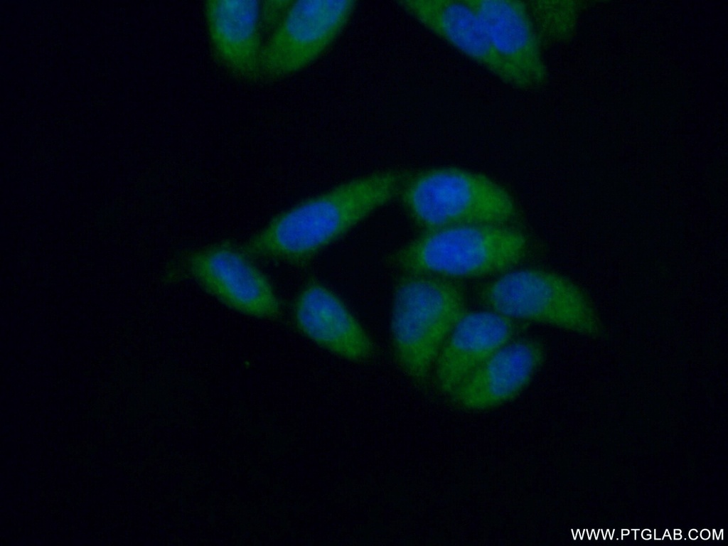 MLL5 Polyclonal antibody