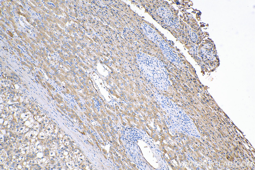 C1S Polyclonal antibody