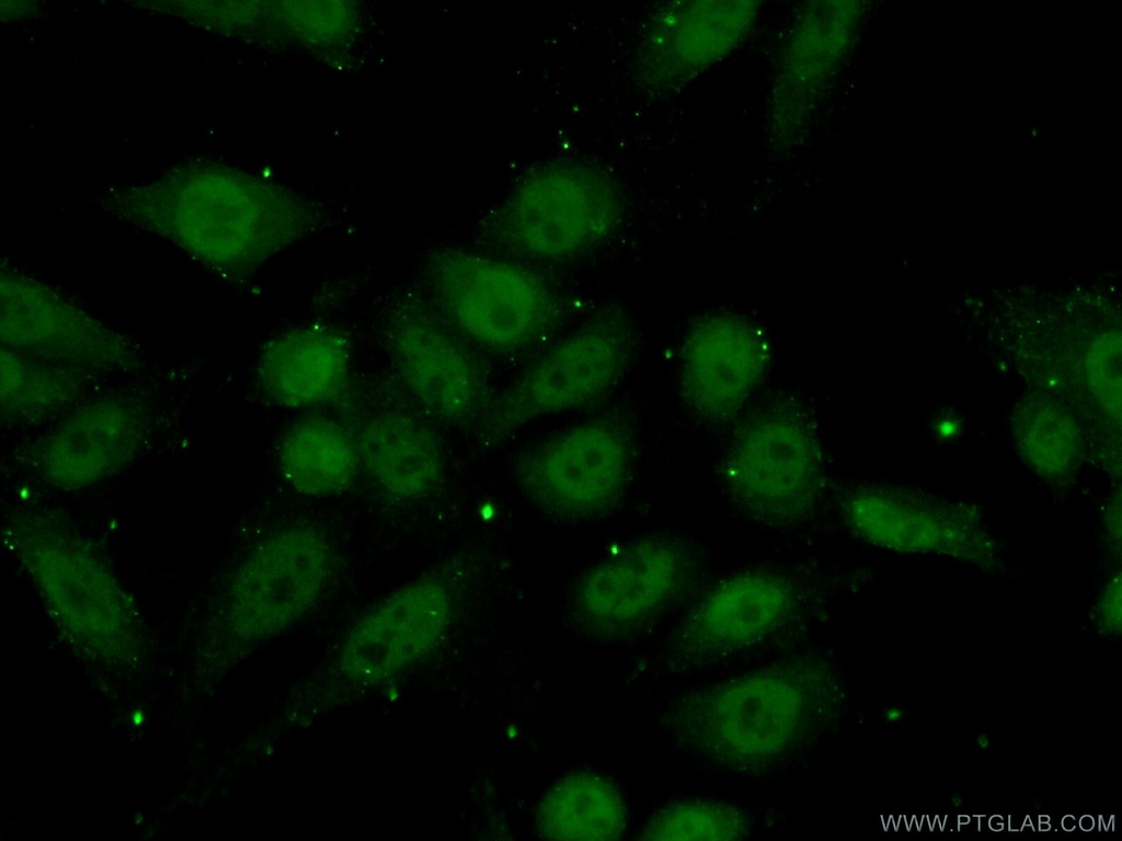 RBAP48 Polyclonal antibody