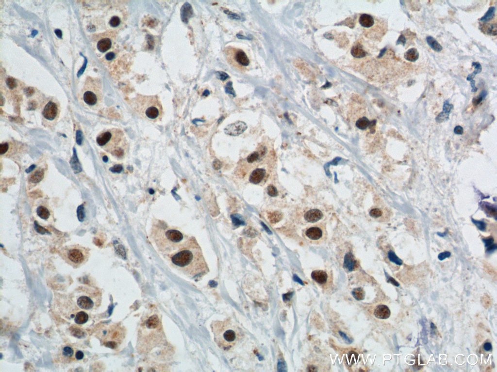 APOBEC3B Polyclonal antibody