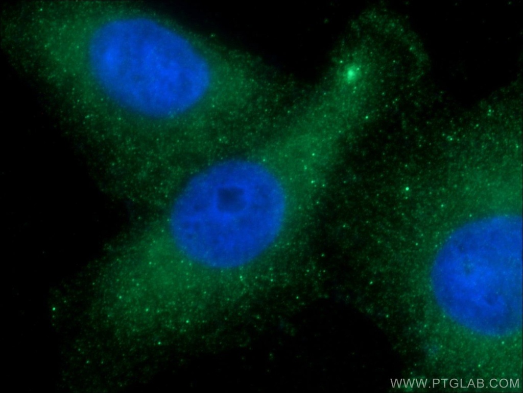 CDR2L Polyclonal antibody
