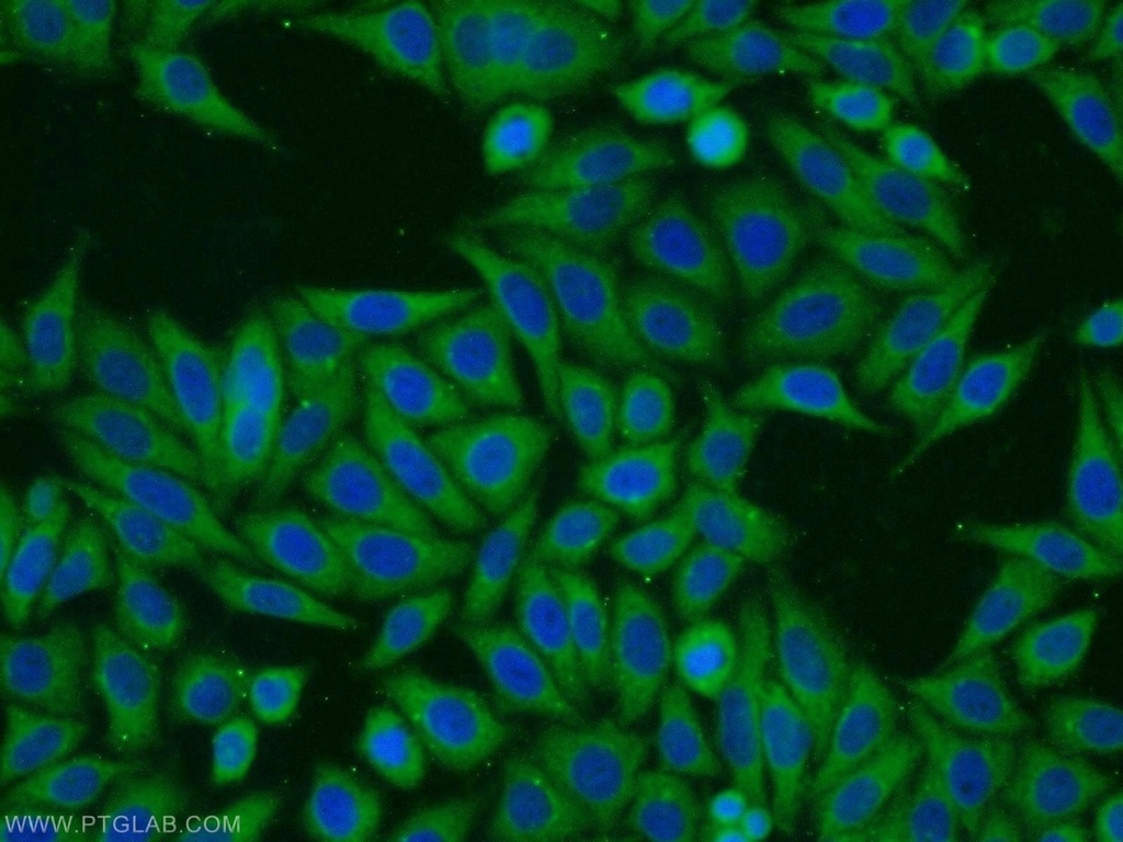 RINT1 Polyclonal antibody