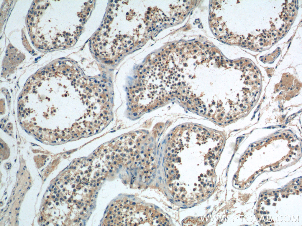 BBS5 Polyclonal antibody