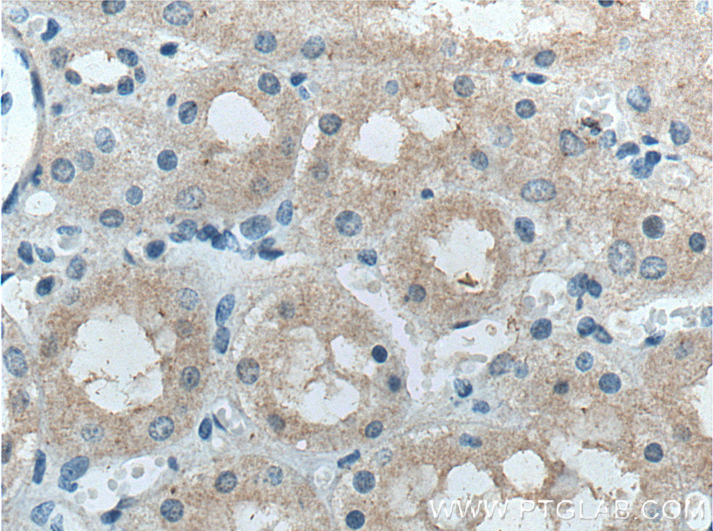 FBXO27 Polyclonal antibody