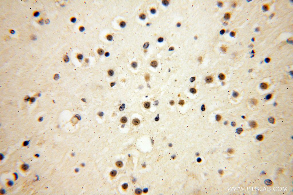 DEDD2 Polyclonal antibody